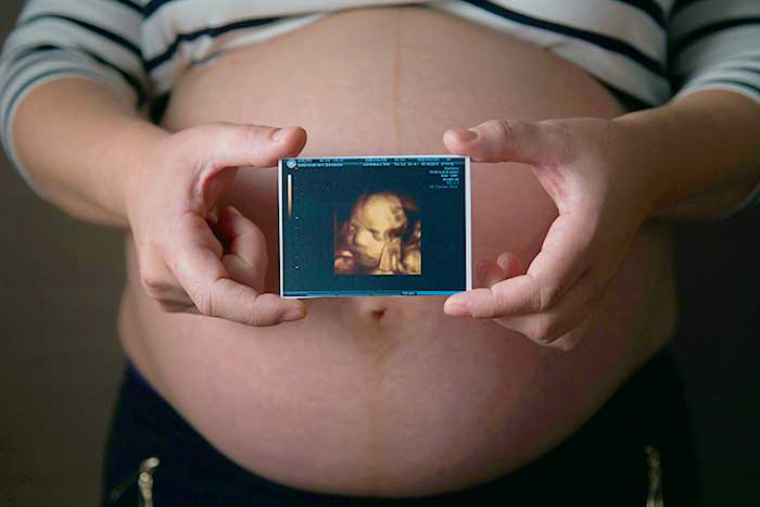 pregnant woman olding ultrasound photo